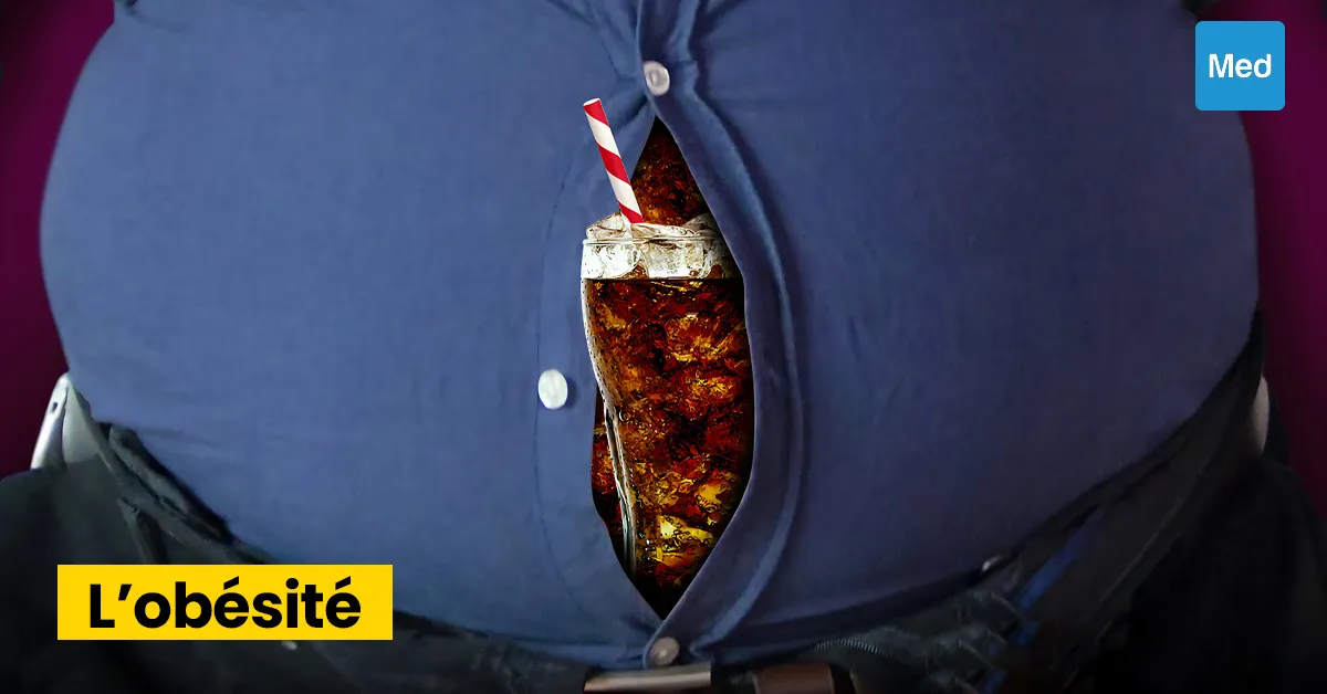 L'Obésité : Comprendre, Prévenir et Gérer